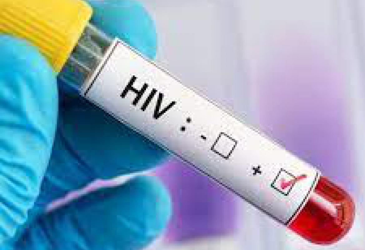 HIV